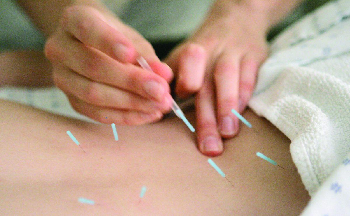 FILE - In this Monday, Sept. 24, 2007 file photo, Anah McMahon, L. Ac. adjusts one inch seirin acupuncture needles in the muscles around the spine of a patient to relieve lower back pain, at the Pacific College of Oriental Medicine in Chicago. Acupuncture gets a thumbs-up for helping relieve pain from chronic headaches, backaches and arthritis in a review of more than two dozen studies - the latest analysis of an often-studied therapy that has as many fans as critics. The new analysis was published online Monday, Sept. 10, 2012 in Archives of Internal Medicine. (AP Photo/M. Spencer Green)