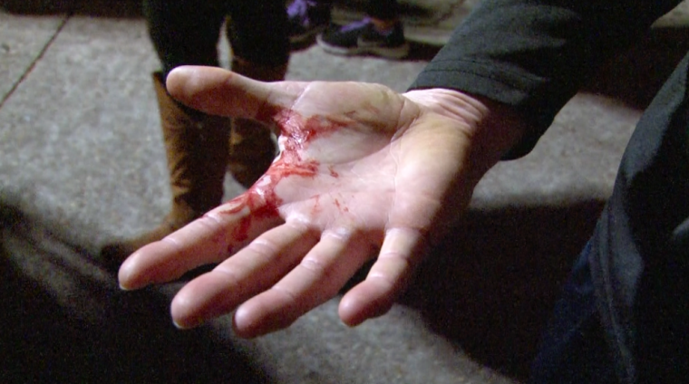 One of the team hopefuls shows off his bloodied hand after an excruciatingly brutal practice to become the best in the nation.&#160;